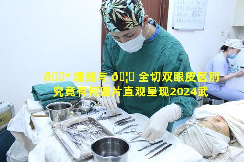 🌺 埋线与 🦈 全切双眼皮区别究竟有何图片直观呈现2024武汉双眼皮医院排名如何确定